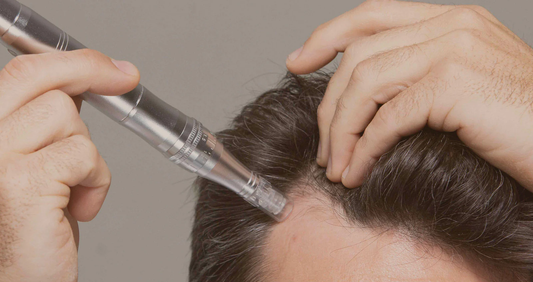 FAQs on Microneedling for Hair Loss with Dr. Pen M8